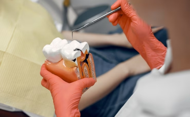 Dental Restoration-------30