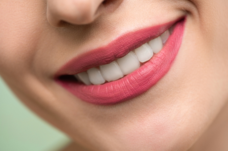 Smile Designing----33